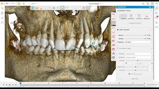 Intégration d’un CBCT avec Spark® Approver [upl. by Col]