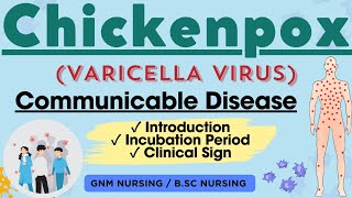 Chickenpox  Varicella zoster virus  Communicable Disease [upl. by Cathyleen]