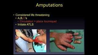 Orthopedic Emergencies lecture by Dr Zevallos [upl. by Ametaf]