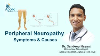 Peripheral Neuropathy Symptoms amp Causes  Dr Sandeep Nayani Neurologist  Apollo Hospitals Hyd [upl. by Fairlie283]