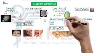 Neurocirugía  1 Traumatismo encéfalo craneano [upl. by Nahsar]