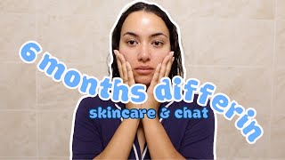 SKIN UPDATE AND LIFE CHAT 🏡🔑  3 months Post Doxycycline and 6 Months Differin Gel Update acne [upl. by Palmer]