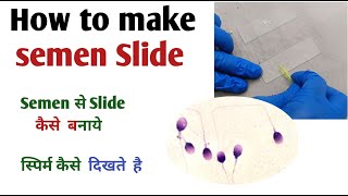 Semen से Slide कैसे बनाये I How to make semen slide [upl. by Yotal974]