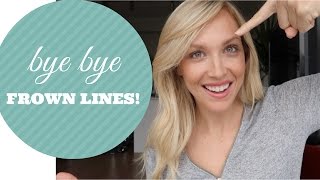 HOW TO GET RID OF FROWN LINES QUICK AND EASY NATURALLY [upl. by Dilaw]