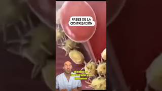 FASES DE LA CICATRIZACIÓN 🤕 enfermeria reels [upl. by Htial]