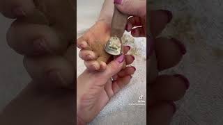 Removing callus from kid hands  Keratoderma hyperkeratosis EPPK skin shaving callous  Apr 2 2023 [upl. by Ariamoy463]