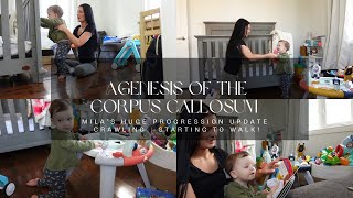 Agenesis of the Corpus Callosum  Mila’s HUGE PROGRESSION UPDATE  Crawling  Starting to WALK [upl. by Ial473]