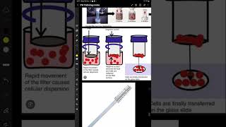 Liquid Based Cytology  Genital System Pathology [upl. by Yssep]