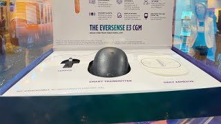 Eversense The 180day Implantable CGM  CEO Interview [upl. by Laemaj]