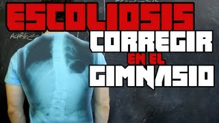 CORREGIR ESCOLIOSIS EN EL GIMNASIO [upl. by Rosmunda]