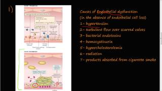 53  Thrombosis Virchows triad Endothelial Injury [upl. by Brufsky]