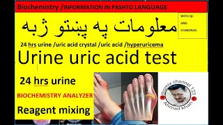 Urine uric acid testuric crystaluricase pap methoduric acid synthesisstone in pashto [upl. by Four733]