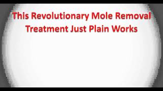 Mole Removal  Naturally Remove Skin Moles [upl. by Saqaw]