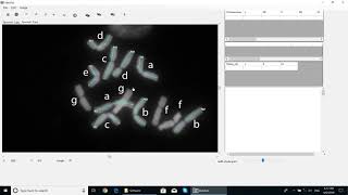 IdeoKar training videoFree karyotyping tool [upl. by Lucrece]