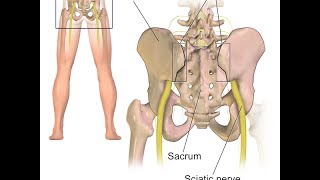 Sacroiliac Joint Pain Explained by Top Pain Doctor in Las Vegas Nevada [upl. by Cicily449]