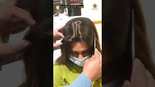 Neferex 4x6 Any Side Parting Hair Topper For Thin Hair  Hair Toppers For Women shorts ytshorts [upl. by Ailekat]