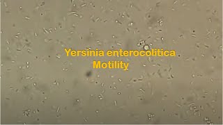 Yersinia Motility Test [upl. by February942]