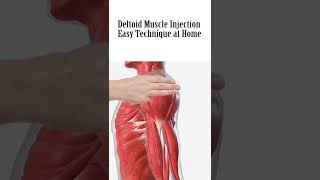 how to give deltoid muscle Injection [upl. by Notgnilra]