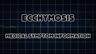 Ecchymosis Medical Symptom [upl. by Eugor940]