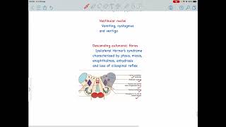 Lateral Medullary Syndrome Wallenburg syndrome PICA syndrome [upl. by Siana362]