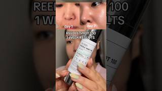 REEDLE SHOT 100 BEFORE AND AFTER 1 week results skincare largepores blackheads koreanskincare [upl. by Novoj]