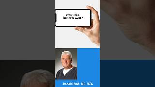 What is a Baker ‘s Cyst cyst orthopedicsurgeon kneepain kneeswelling [upl. by Elnar]