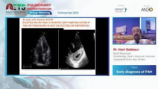 ETS Pulmonary Hypertension Webinar [upl. by Andrew]