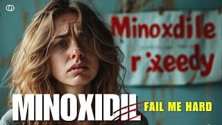 Minoxidil fail me hard [upl. by Okomom]