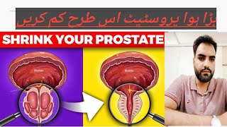 The ONE FOOD That Shrinks an Enlarged Prostate [upl. by Kuhlman]