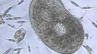 Ciliate Phylum of Protozoa [upl. by Ajaj]