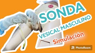 Colocación de Sonda Vesical  Fácil [upl. by Soirtemed]