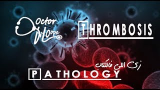 Thrombosis  Pathology زي اللي فالكتاب  Doctor HOopa [upl. by Havot763]