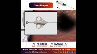 Trucut biopsy [upl. by Bloom]