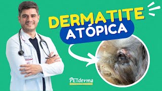 O que é Dermatite Atópica [upl. by Ammeg]