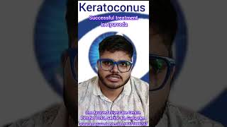 Keratoconus  Ayurveda eye Treatment [upl. by Lowry]