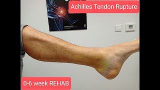 Achilles tendon rupture 06 week Rehabilitation protocol Riabilitazione rottura tendine dAchille [upl. by Meredeth]