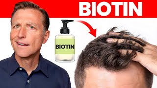 Does Biotin or Biotin Shampoo Really Work for Hair Loss [upl. by Corilla]