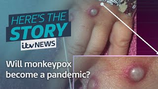 Will monkeypox become a pandemic  ITV News [upl. by Jamieson]