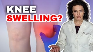 Knee Pain and Swelling  Why and How to Get Relief [upl. by Fortna]