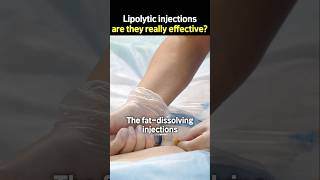 Lipolytic injections are they really effective [upl. by Eihtur]