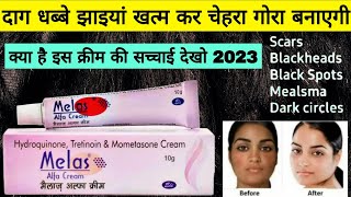 melas melas cream review  pigmentation  blemishes  dark spot  daag dabbe hatane wali cream [upl. by Arded355]