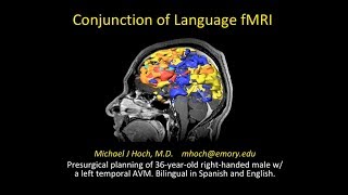 Functional MRI fMRI BOLD imaging  using conjunction display for language mapping [upl. by Ealasaid]