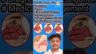 Rhinitis in Hindi  Causes Symptoms and Treatment of Rhinitis  Allergic And Non Allergic Rhinitis [upl. by Geminius559]