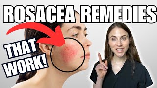 5 Rosacea Remedies THAT WORK  Dermatologist Tips [upl. by Nailluj288]