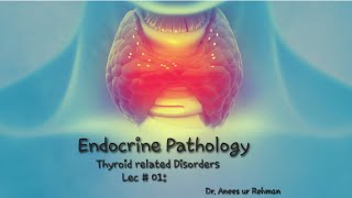 Endocrine Pathology  Hashimotos Thyroiditis lec 01 Pathology robbinsbasicpathology concept [upl. by Mcdonald]