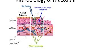 SGX942 Pathobiology of Mucositis animation [upl. by Saleem]