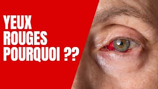 Les yeux Rouges  Les Causes et Solutions [upl. by Essirahc]