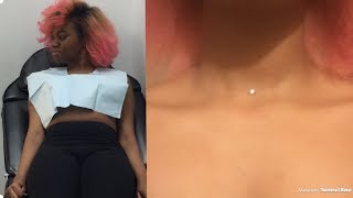 I snuck and got my a dermal in my neck 😳 neck dermal piercing [upl. by Sidnac148]