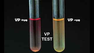 Voges Proskauer Test [upl. by Mellette815]