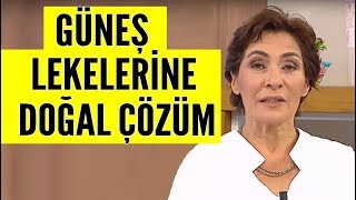 Yüz ve eldeki güneş lekeleri için doğal çözüm [upl. by Birkle]